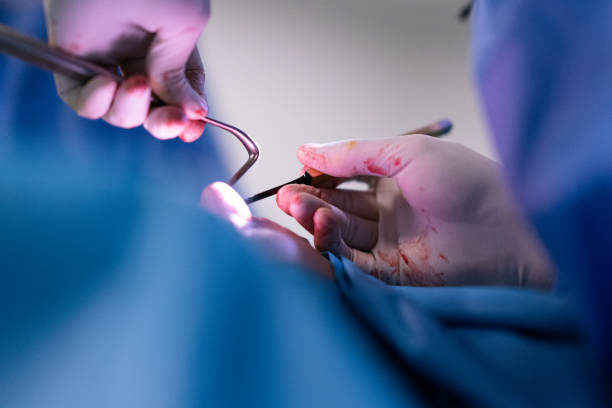 risks nose surgery risks nose surgery Dr Stephen Kleid
