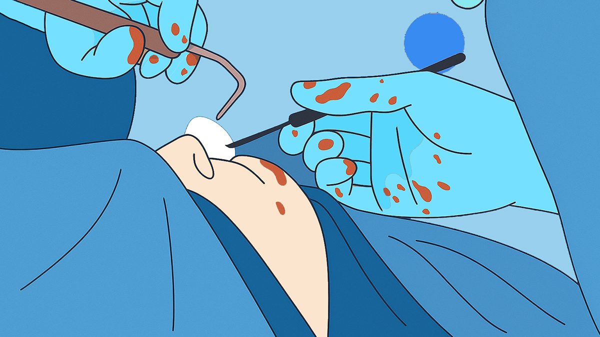 Melbourne ENT Operation Procedure Rhinoplasty