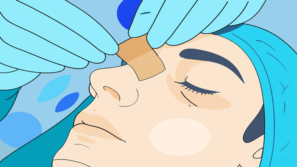 Melbourne ENT Rhinoplasty Recovery Woman Image Melbourne ENT Rhinoplasty Recovery Woman Image