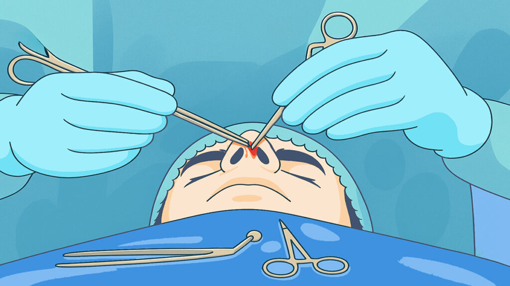 Melbourne-ENT-During-Nose-surgery