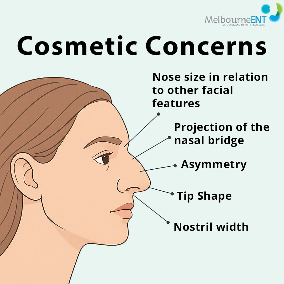 Rhinoplasty Nose Job at Melbourne ENT Clinic Rhinoplasty Nose Job at Melbourne ENT Clinic