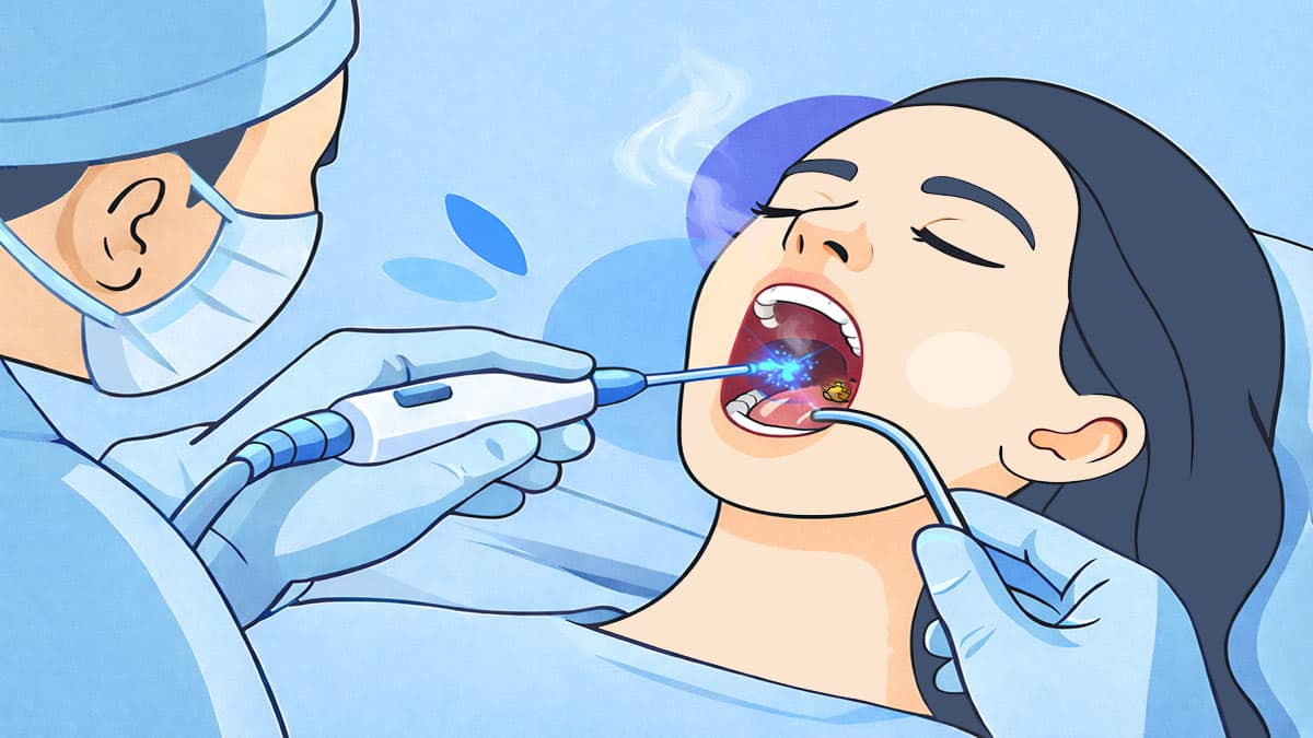 Cold Ablation Techniques for Tonsils Melbourne ENT - Blog image