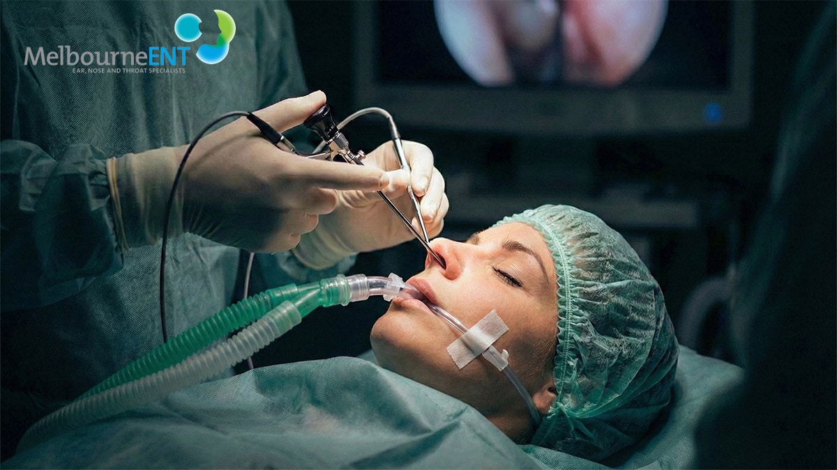 Nasal Polyps Surgery (Polypectomy) Melbourne - ENT