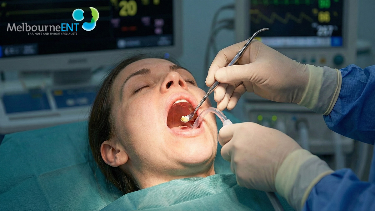 Tonsil Stones Melbourne - Also Known As Tonsilloliths Featured Image - Melbourne ENT