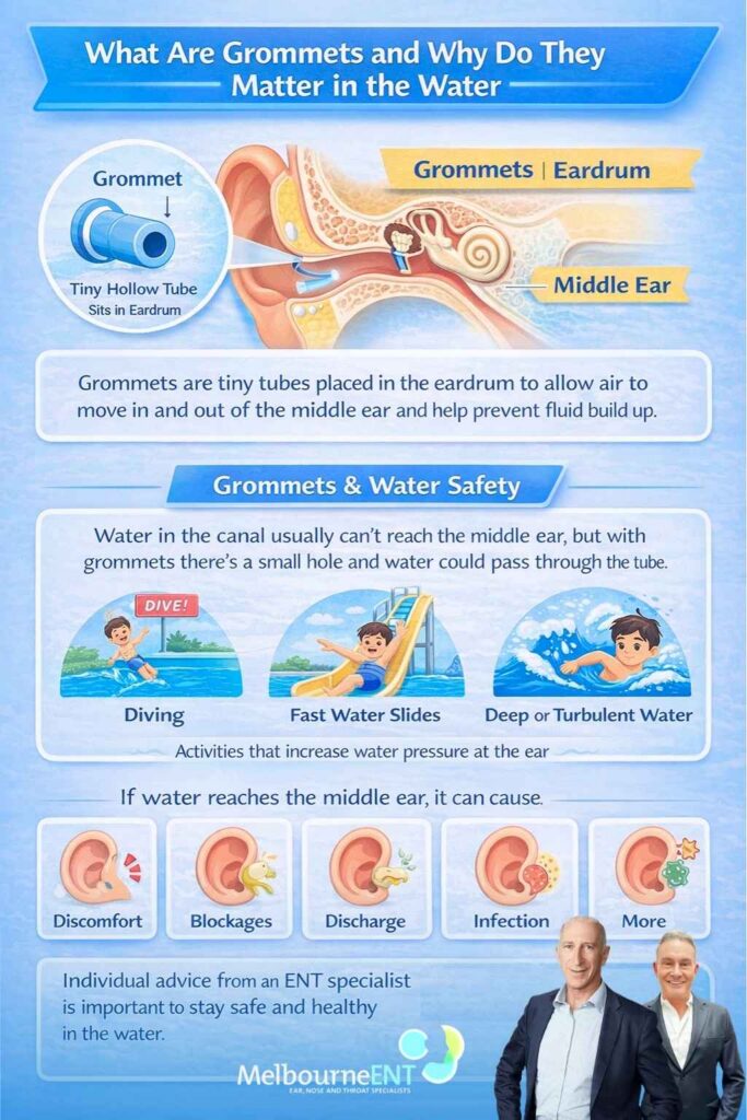 What are grommets and why do they matter in the water MelbourneENT explained